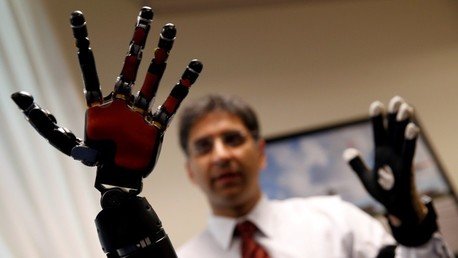 Video: Controla sus brazos con la mente después de pasar 40 años amputado