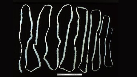 Sin precedentes: un colombiano muere tras contraer un cáncer "no humano"