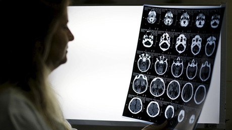 Una tribu caníbal hizo un favor a la ciencia comiendo cerebros