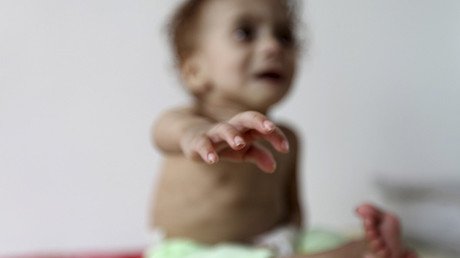 Espeluznantes imágenes de niños famélicos nos muestran la crueldad de una guerra olvidada