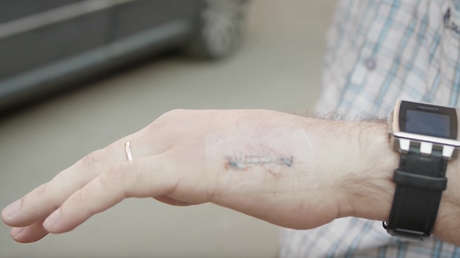 Video: Ingeniero ruso se implanta una tarjeta de transporte en su mano