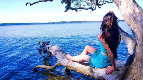 Fotos: 'Imprimen' en 3D parte del cráneo de una modelo tras un accidente casi mortal