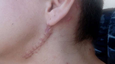 FUERTES IMÁGENES: Ex esclava sexual muestra las lesiones que le causaron sus captores