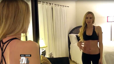 FOTOS: Una mujer es su propia hermana gemela a causa de esta rara condición genética