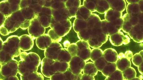 Un antibiótico descubierto en la URSS ofrece esperanza contra las superbacterias más resistentes