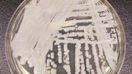 Qué es el peligroso hongo 'Candida auris', que ya ha sido detectado en 32 países