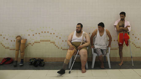 ONU: 1.700 palestinos heridos por las fuerzas israelíes podrían ser amputados por falta de fondos