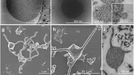 Descubren un microorganismo que puede explicar el origen de la vida