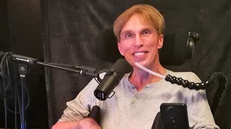 FOTOS: Le diagnostican una enfermedad fatal y decide transformarse en el primer cíborg en la historia