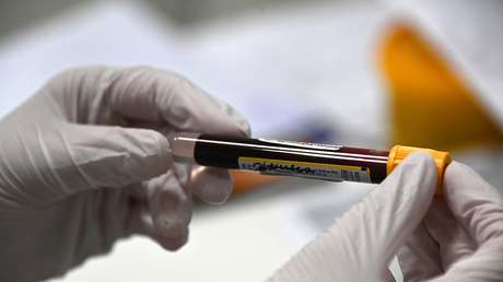 "No hay ninguna razón para dudar de los resultados": Expertos británicos evalúan información sobre la vacuna rusa Sputnik V