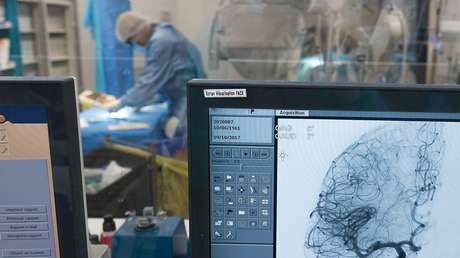 Científicos detectan daños en vasos sanguíneos del cerebro de pacientes que murieron por covid-19