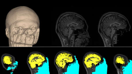 Desarrollan un método que puede modificar el funcionamiento del cerebro para reducir los miedos, cambiar los gustos y aumentar la confianza