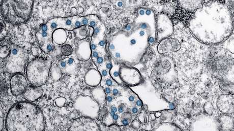 Un experto advierte que la sífilis y otras dos infecciones están "completamente fuera de control" en España