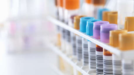 Ghana confirma sus dos primeros casos del virus de Marburgo, una enfermedad altamente infecciosa similar al ébola