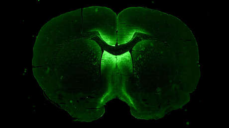 Cultivarán 'minicerebros' humanos en 3D en la Estación Espacial Internacional