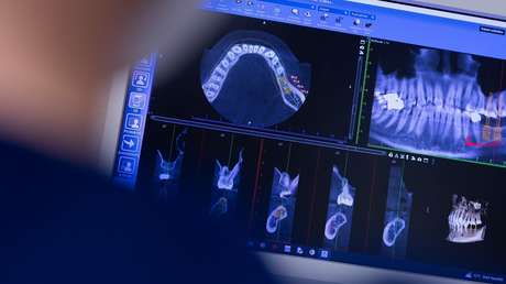 Dentista practica más de 30 procedimientos en una sola cita y deja "lesiones importantes" a una paciente