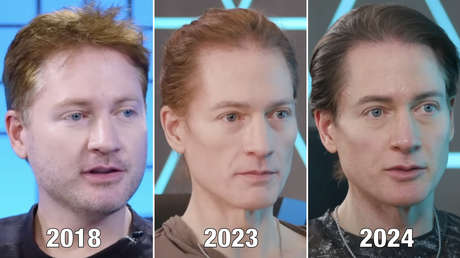 'Biohacker' multimillonario muestra el progreso de revertir su envejecimiento