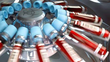 Varias personas contrajeron VIH a través del 'vampiro facial' en EE.UU.