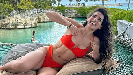 Una 'influencer' mexicana se pone bótox y casi muere por infarto cerebral