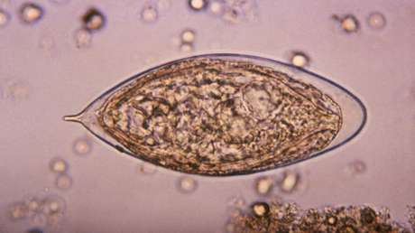 Una infección a menudo ignorada podría aumentar el riesgo de cáncer