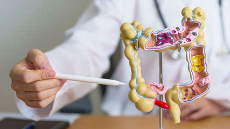 Estos sencillos cambios en la dieta reducen el riesgo de cáncer de colon