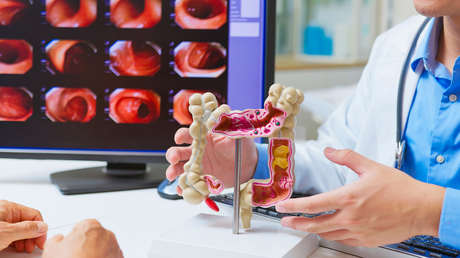 La pérdida de esta proteína podría provocar cáncer de colon