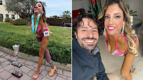 'Influencer' sin brazos y con una pierna protésica inspira y conquista la Red