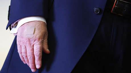 La curiosa explicación de la Casa Blanca para los extraños vendajes en la mano de Trump