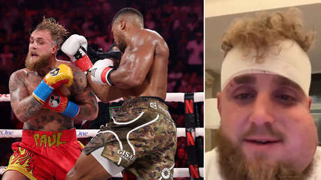 Jake Paul muestra cómo le quedó la cara después de su pelea con Anthony Joshua (VIDEO)