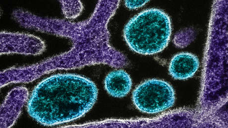 Letal virus incurable deja una víctima mortal en un nuevo país