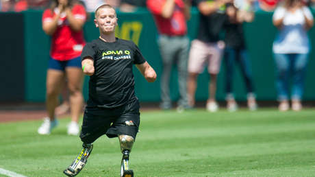 Hombre sin cuatro extremidades enfrenta cargos de asesinato por un tiroteo