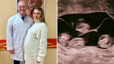 Un caso único en millones: Rusia celebra el nacimiento de sus primeras cuatrillizas idénticas