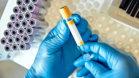 La crisis de los microplásticos podría estar sobredimensionada y los científicos encontraron al culpable 'en casa'