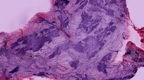 Este avance en microscopía deja ver lo que antes era imposible
