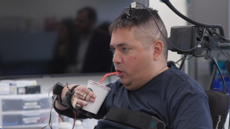 Paciente con parálisis completa recupera movilidad en las manos tras recibir implante cerebral